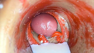 Camera Inside Deep Pussy Captures Big dose Ejaculation of Sperm ASMR