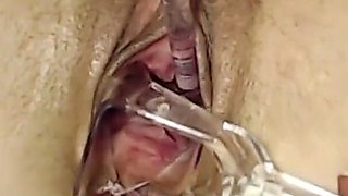 Extreme Pussy Play with Speculum and Peehole Fuck