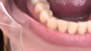 Glasses & Gape: 11-min Dental Speculum-stretched Drool Session