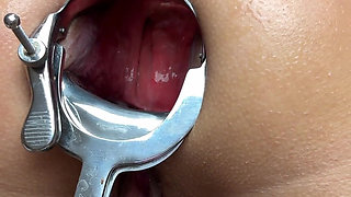 14.october.2025 Video Quickie Gape, Speculum, Anal Speculum, Anal, Hkj, Hotkinkyjo, Boobs, Ass, Asshole, Pornstar