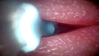 I couldn't believe what happens INSIDE the penis as sperm passes through (endoscopic footage)