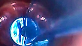Endoscope POV: Test Tube Cock Urethral Insertion