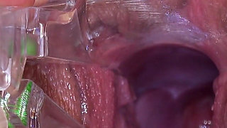 Speculum Exam of Hot Nerdy Teen Keira Flow