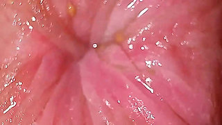 18 Years Old Girl Pussy and Anal Smell Specifically! Try to Imagine Looking Close up!