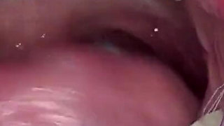 Playing and Swallowing a Candy-filled Condom in the Shape of a Rabbit