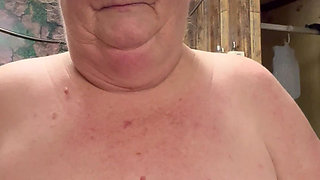 Bad Case of Shingles