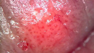 Medical Endoscope Oral Exam: Gummy Chewing, Extreme Teeth & Tongue Macro