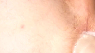 Dominatrix Causes Extreme Rosebud and Fat Ass Lips