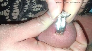 Hubby gets the works but no relief