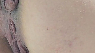 Pissing with a Huge Hemorrhoid in My Asshole Anal Problems