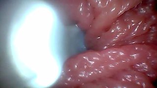 Teen POV: Endoscope G-Spot Close-Up – First Time Deep Pussy Exam