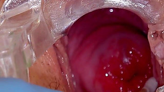 Cervical Examination of a Young Muslim Zeynep Rossa