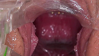 Pussy Exam of Hot College Student Juliia