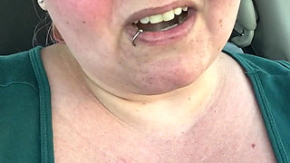Got a Sunburn for Art Supplies!