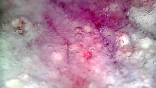 Medical Endoscope Oral Exam: Gummy Chewing, Extreme Teeth & Tongue Macro
